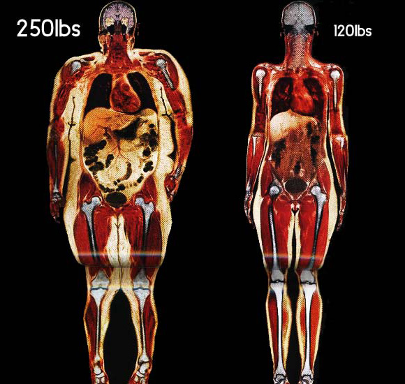 body_scans